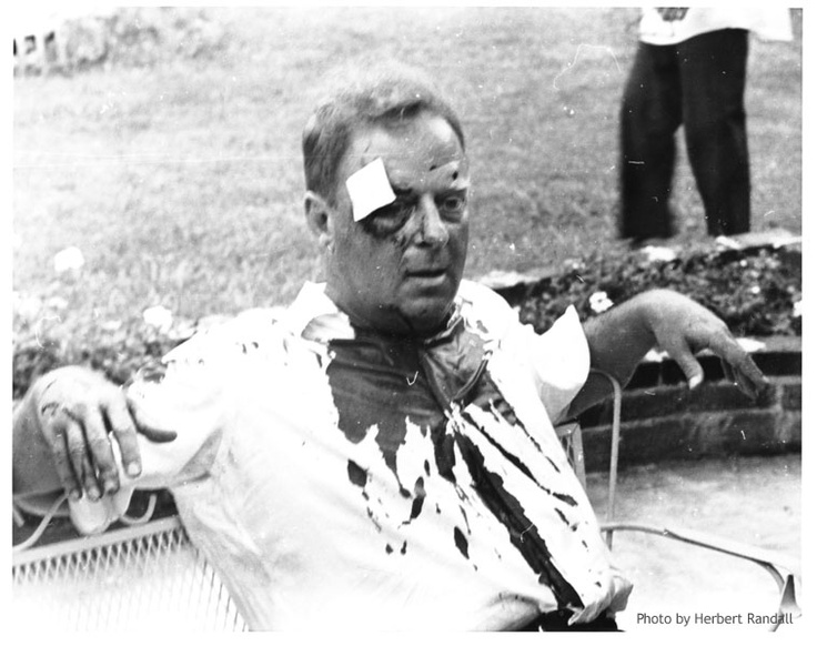Rabbi Lelyveld after being beaten during voter registration in Hattiesburg, MS, 1964. © Herbert Randall
